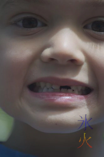 Gap toothed grin Gap toothed grin